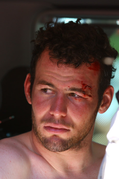 額に痛々しい傷を負ったマーク・カヴェンディッシュ（イギリス、HTC・ハイロード）