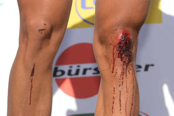 膝から血を流しながら表彰台に上がるナセル・ブアニ（フランス、FDJ.fr）