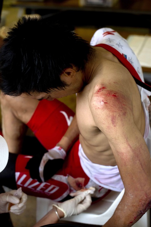 山本幸平（スペシャライズド）は左半身にたくさんの傷を負っていた