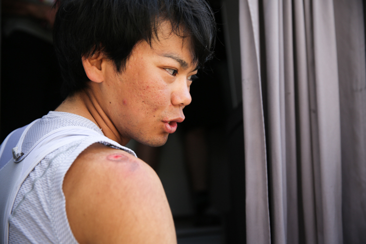前日の落車で右肩も打った新城幸也(ユーロップカー)