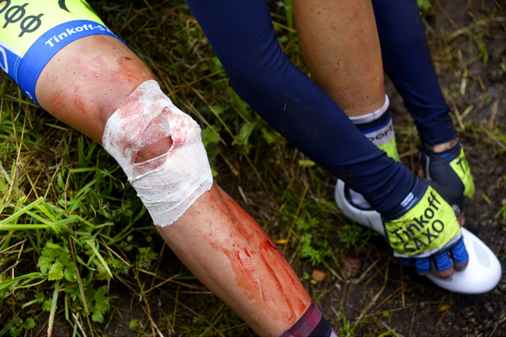 流血するアルベルト・コンタドール（スペイン、ティンコフ・サクソ）の右膝