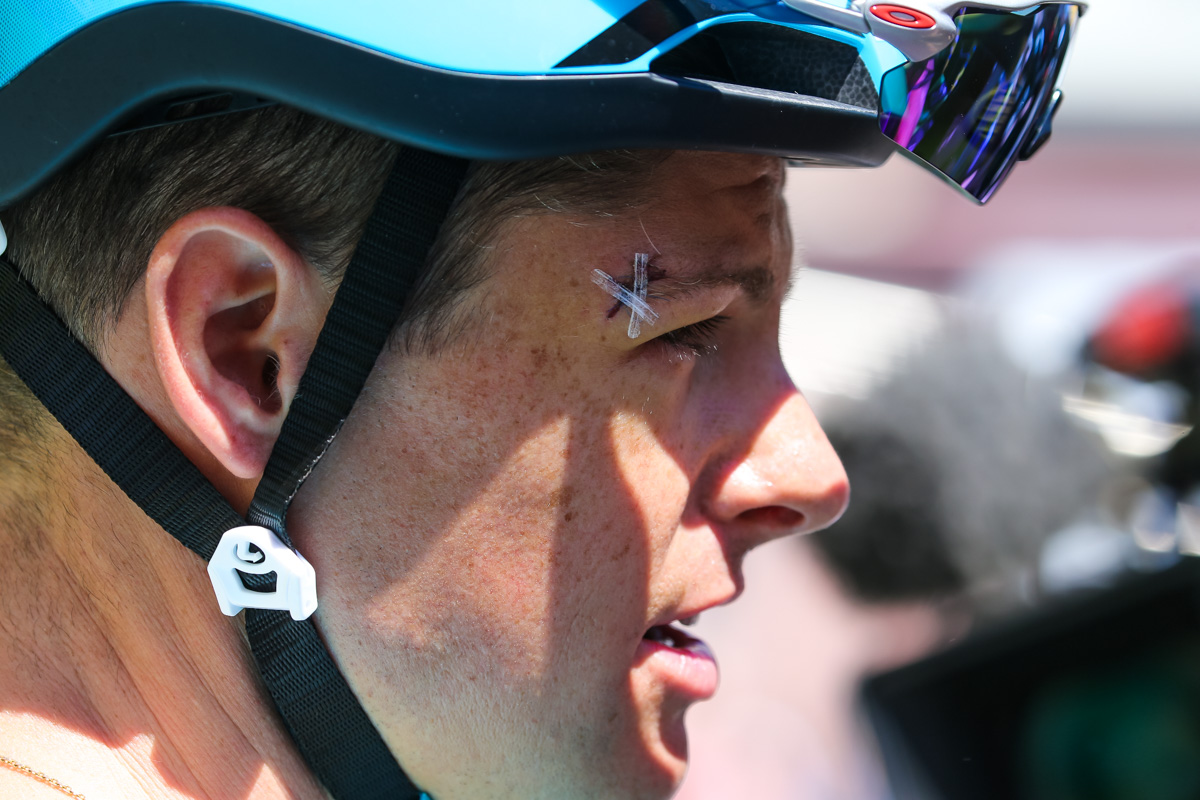 第1ステージの落車で瞼をふた針縫ったヤコブ・フルサング（デンマーク、アスタナ）
